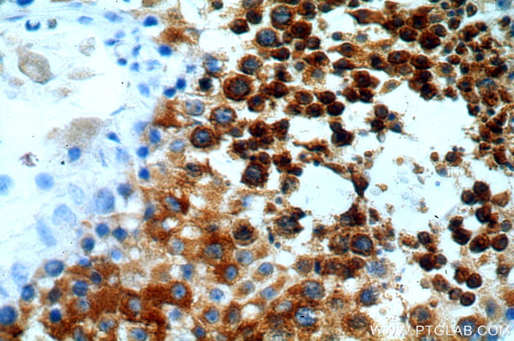 Immunohistochemistry (IHC) staining of human testis tissue using CALCOCO1 Polyclonal antibody (19843-1-AP)