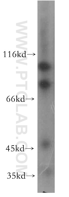 Western Blot (WB) analysis of MCF-7 cells using CALCOCO1 Polyclonal antibody (19843-1-AP)