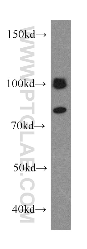 Western Blot (WB) analysis of HT-1080 cells using CALCOCO1 Polyclonal antibody (19843-1-AP)