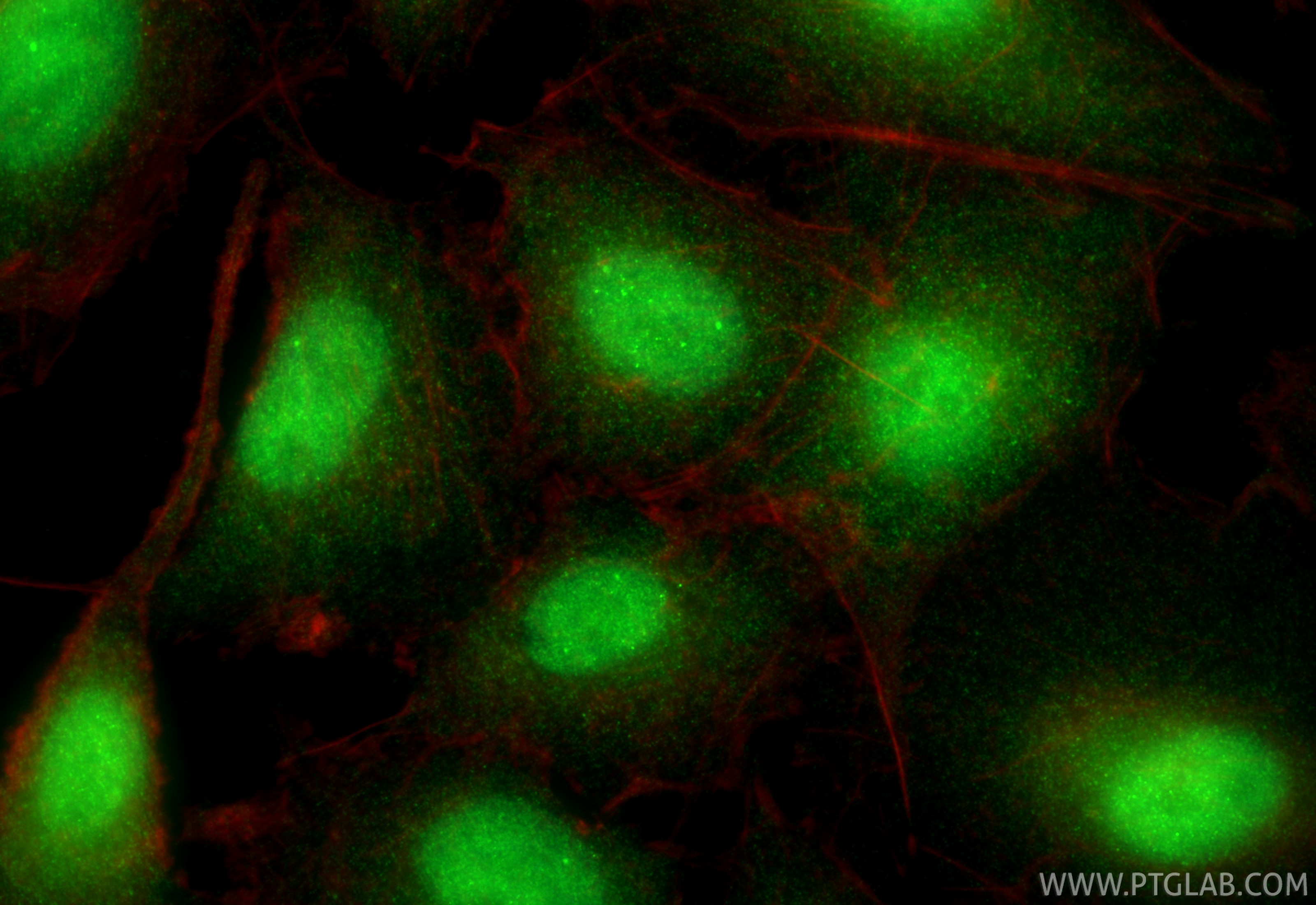 Immunofluorescence (IF) / fluorescent staining of A549 cells using CALCOCO1 Recombinant antibody (84009-5-RR)
