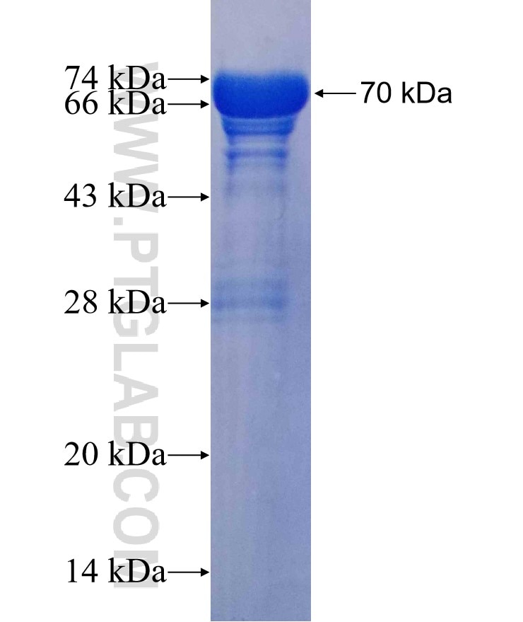 CALCOCO1 fusion protein Ag13876 SDS-PAGE