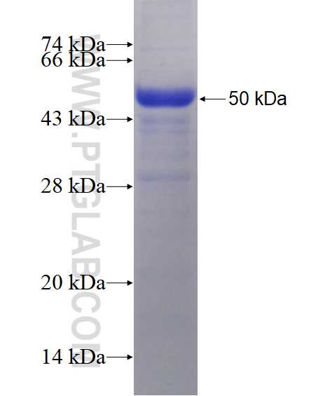 CALCOCO1 fusion protein Ag14837 SDS-PAGE