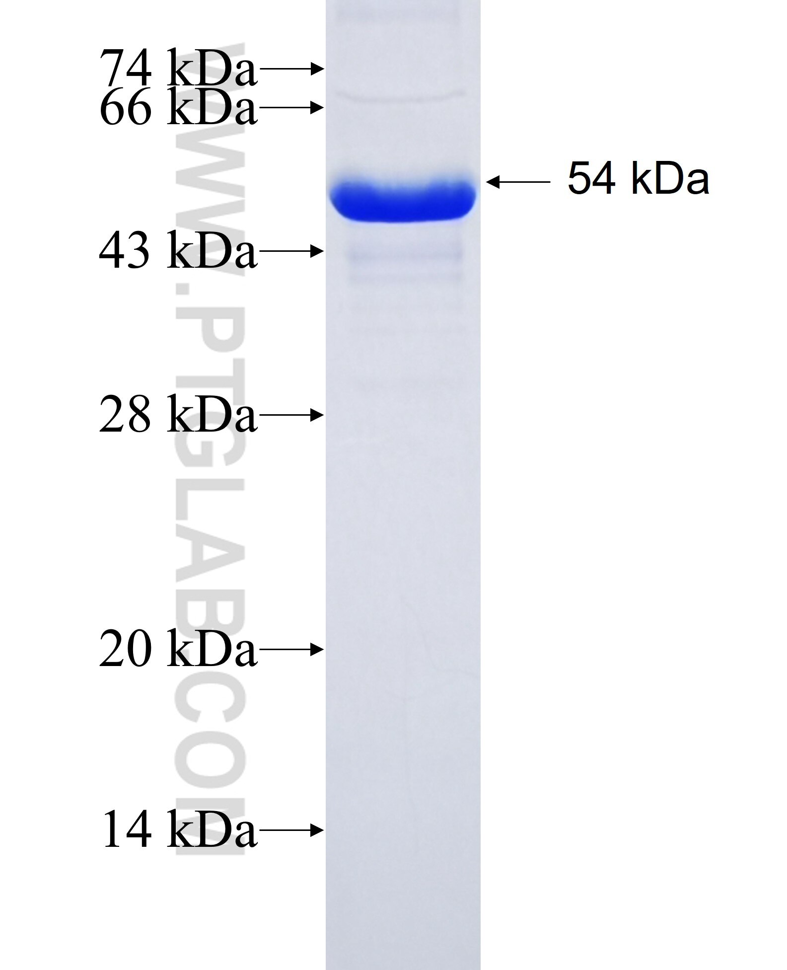 CALCOCO1 fusion protein Ag14837 SDS-PAGE