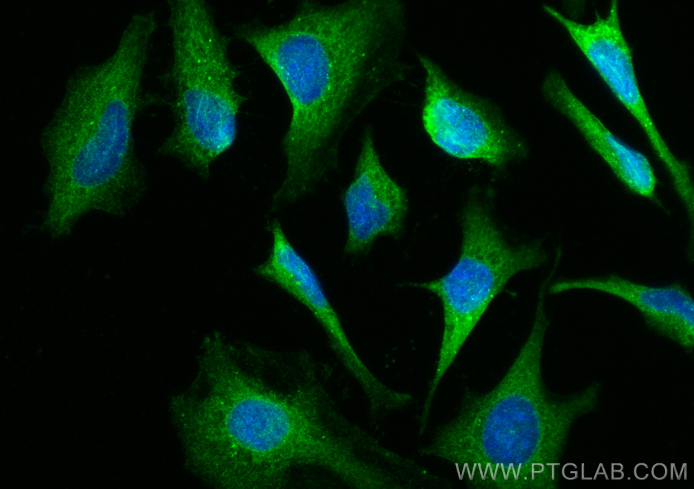 Immunofluorescence (IF) / fluorescent staining of HeLa cells using NDP52 Polyclonal antibody (12229-1-AP)