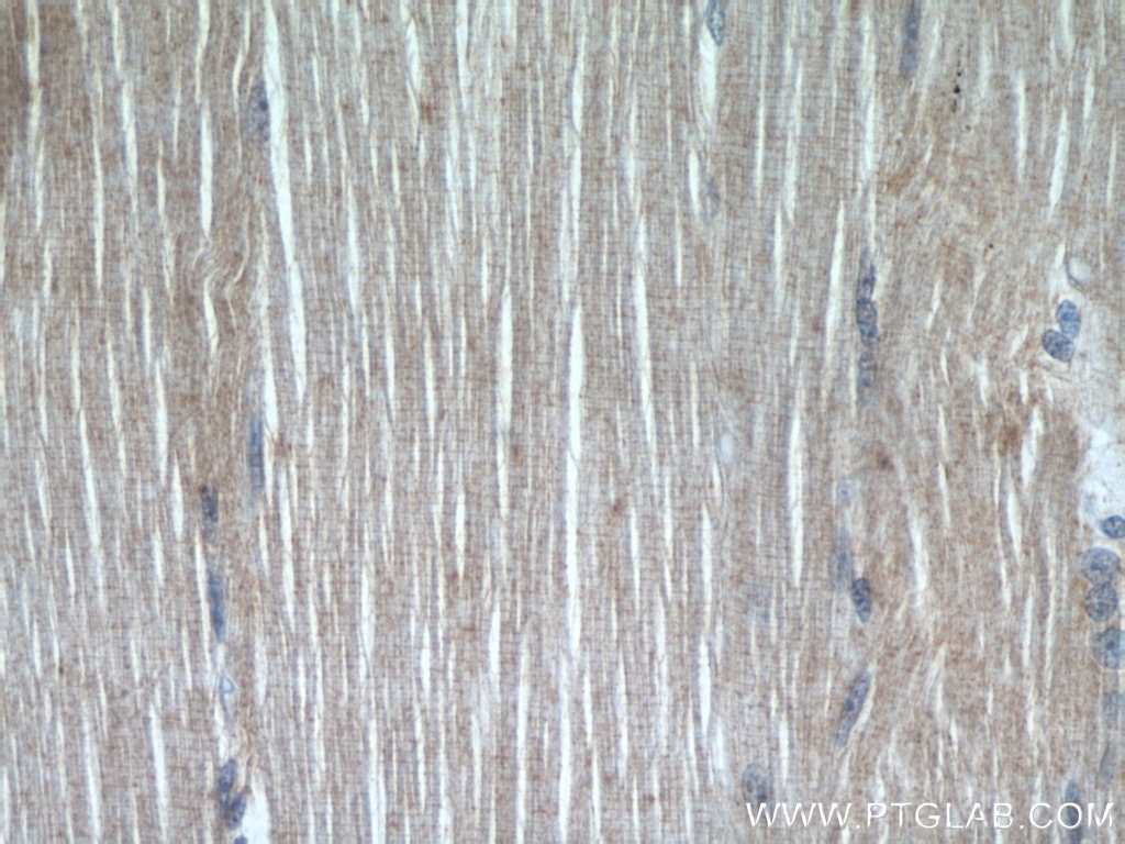Immunohistochemistry (IHC) staining of human skeletal muscle tissue using NDP52 Polyclonal antibody (12229-1-AP)