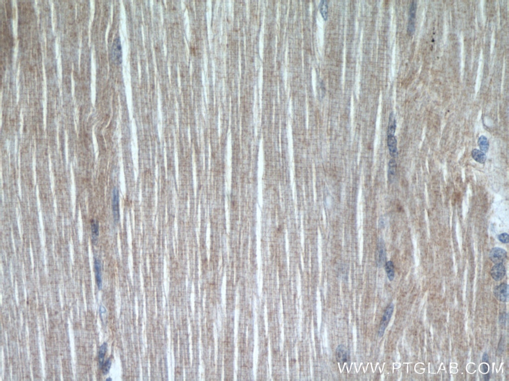 IHC staining of human skeletal muscle using 12229-1-AP