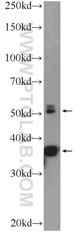 WB analysis of rat skeletal muscle using 12229-1-AP