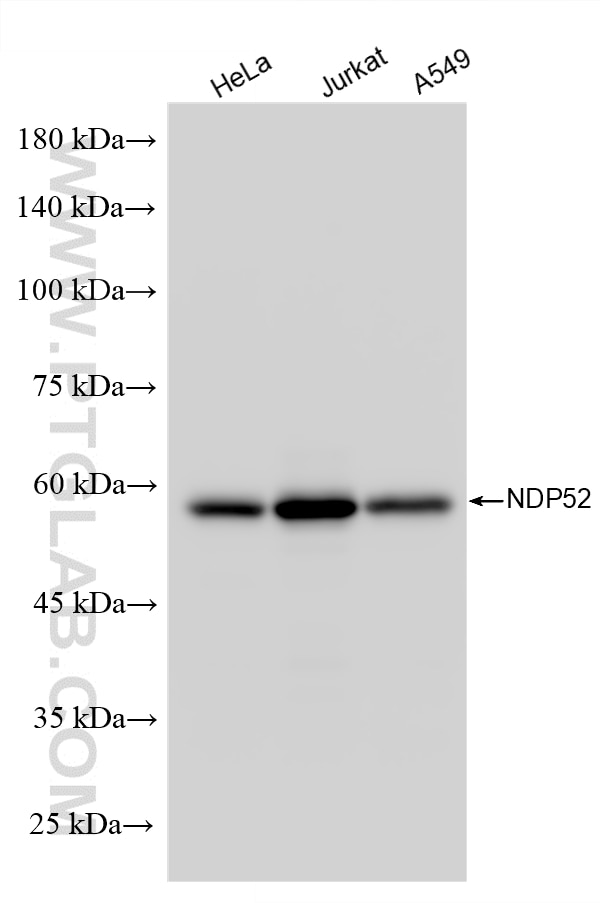 Various lysates were subjected to SDS PAGE followed by western blot with 12229-1-AP (NDP52 antibody) at dilution of 1:10000 incubated at room temperature for 1.5 hours. Western Blot (WB) analysis of various lysates using NDP52 Polyclonal antibody (12229-1-AP)