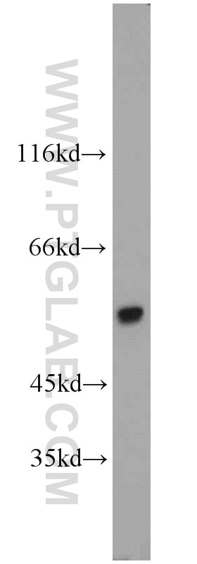 Western Blot (WB) analysis of Jurkat cells using NDP52 Polyclonal antibody (12229-1-AP)