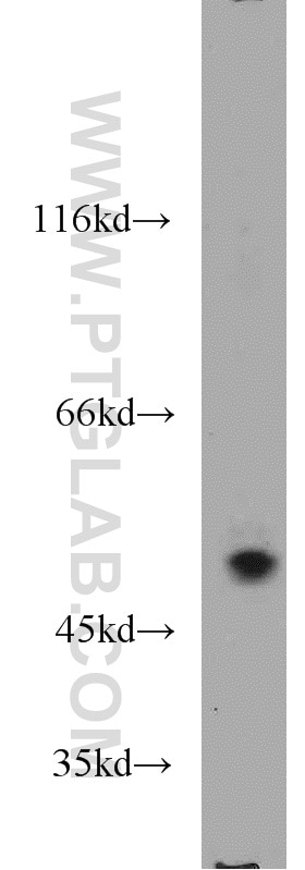 Western Blot (WB) analysis of human placenta tissue using NDP52 Polyclonal antibody (12229-1-AP)