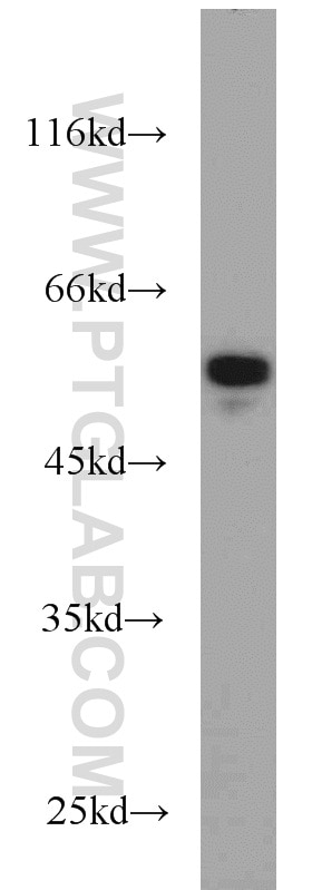 Western Blot (WB) analysis of Jurkat cells using NDP52 Polyclonal antibody (12229-1-AP)