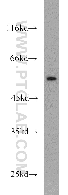 Western Blot (WB) analysis of mouse skeletal muscle tissue using NDP52 Polyclonal antibody (12229-1-AP)