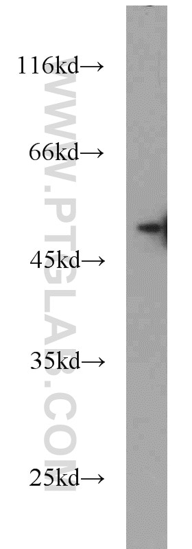 Western Blot (WB) analysis of HeLa cells using NDP52 Polyclonal antibody (12229-1-AP)