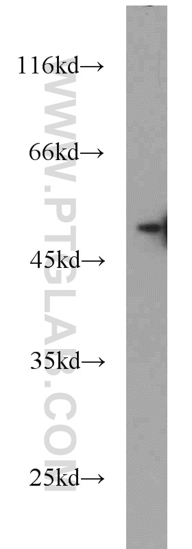 WB analysis of HeLa using 12229-1-AP