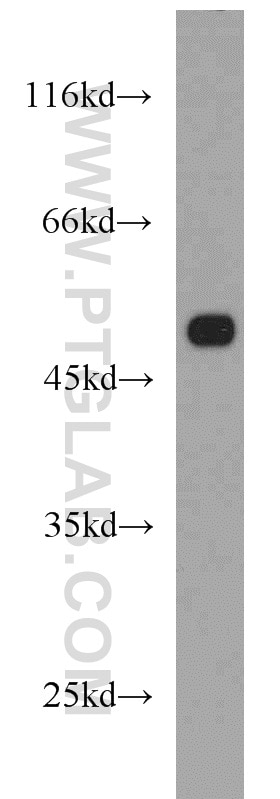 Western Blot (WB) analysis of HeLa cells using NDP52 Polyclonal antibody (12229-1-AP)