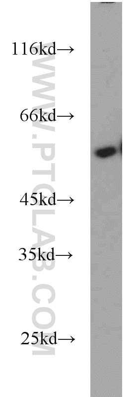 Western Blot (WB) analysis of human placenta tissue using NDP52 Polyclonal antibody (12229-1-AP)