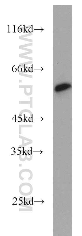 Western Blot (WB) analysis of human placenta tissue using NDP52 Polyclonal antibody (12229-1-AP)