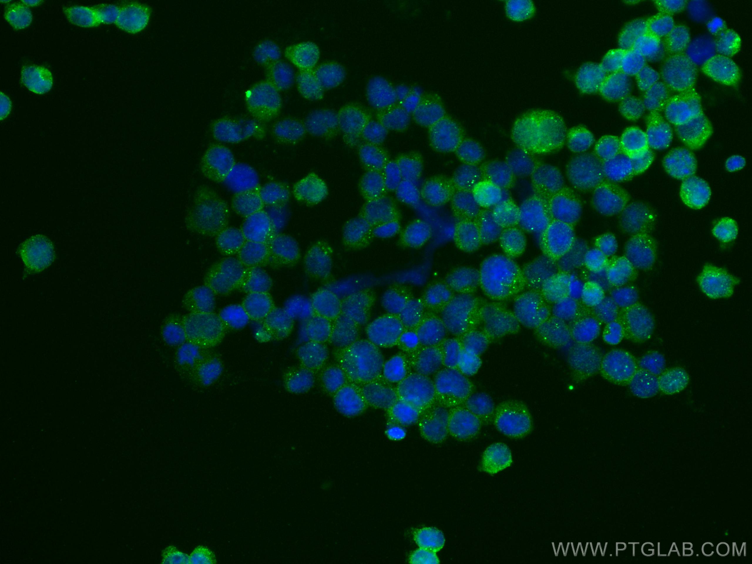 Immunofluorescence (IF) / fluorescent staining of Jurkat cells using NDP52 Monoclonal antibody (66401-1-Ig)