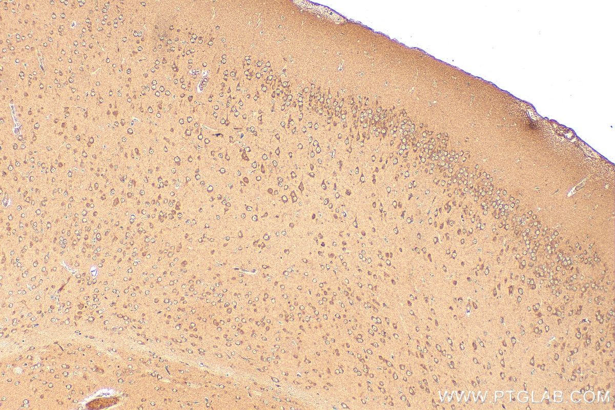 Immunohistochemistry (IHC) staining of mouse brain tissue using NDP52 Monoclonal antibody (66401-1-Ig)