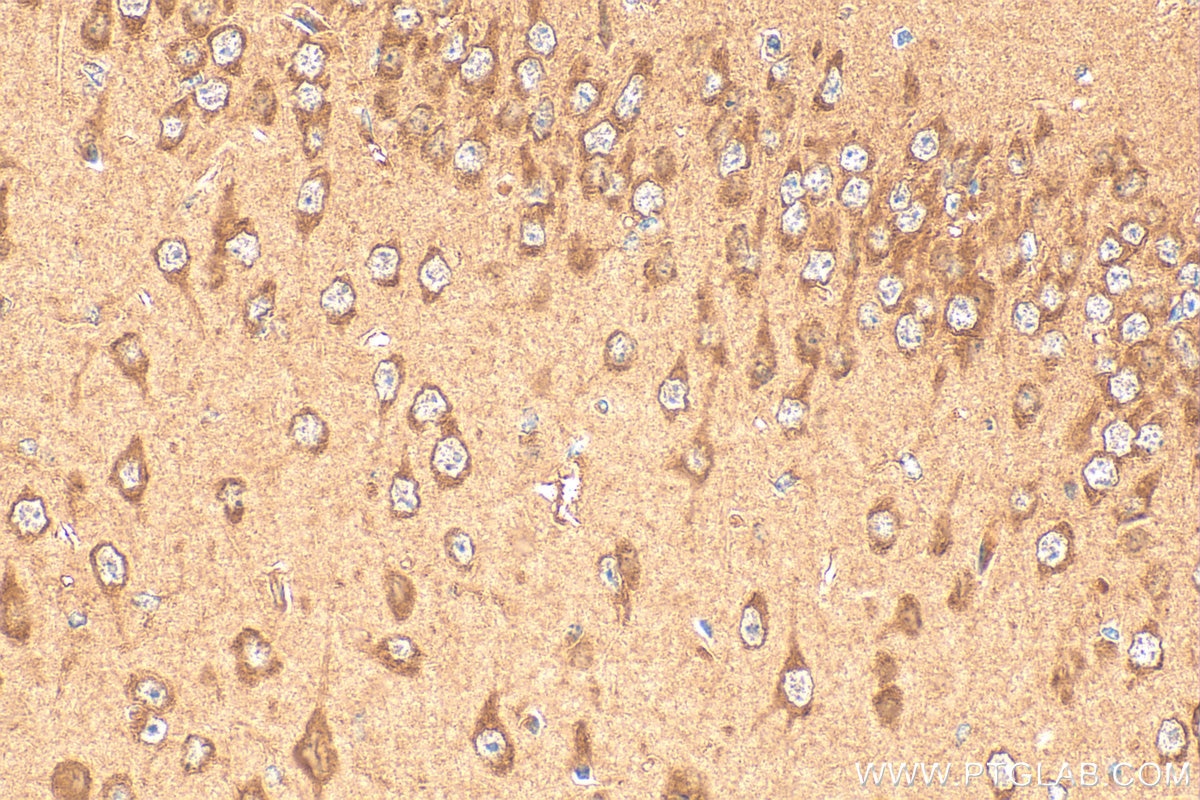 Immunohistochemistry (IHC) staining of mouse brain tissue using NDP52 Monoclonal antibody (66401-1-Ig)