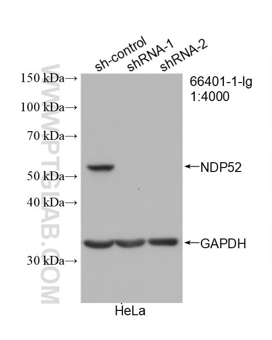 Western Blot (WB) analysis of HeLa cells using NDP52 Monoclonal antibody (66401-1-Ig)