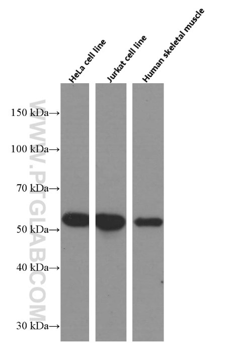 Western Blot (WB) analysis of HeLa cells using NDP52 Monoclonal antibody (66401-1-Ig)