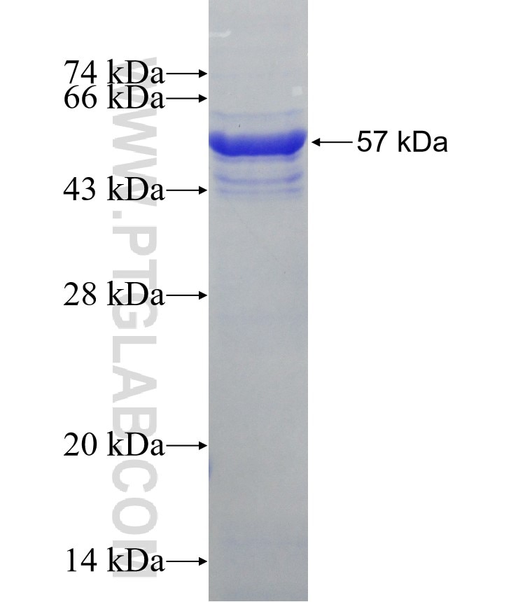 CALCOCO2 fusion protein Ag2866 SDS-PAGE