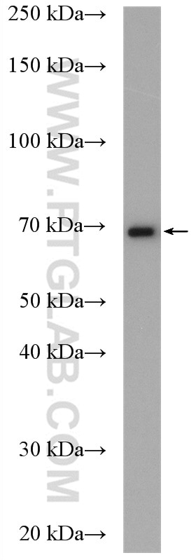 Western Blot (WB) analysis of MCF-7 cells using CALCR Polyclonal antibody (20868-1-AP)