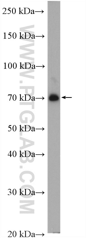 Western Blot (WB) analysis of mouse brain tissue using CALCR Polyclonal antibody (20868-1-AP)