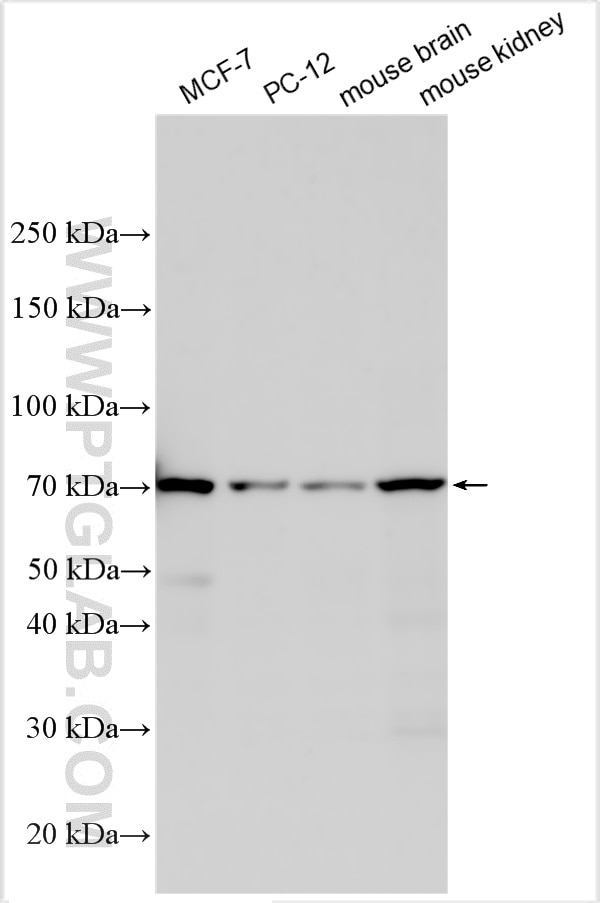 Western Blot (WB) analysis of various lysates using CALCR Polyclonal antibody (20868-1-AP)