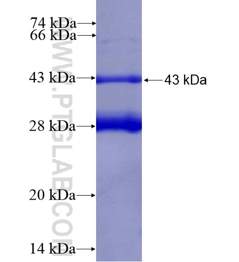 CALCR fusion protein Ag14920 SDS-PAGE