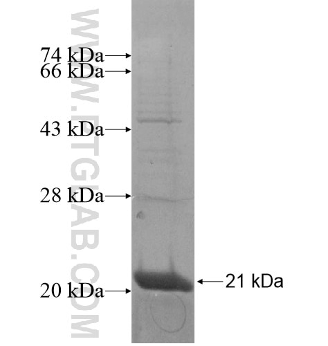 CALCR fusion protein Ag14987 SDS-PAGE