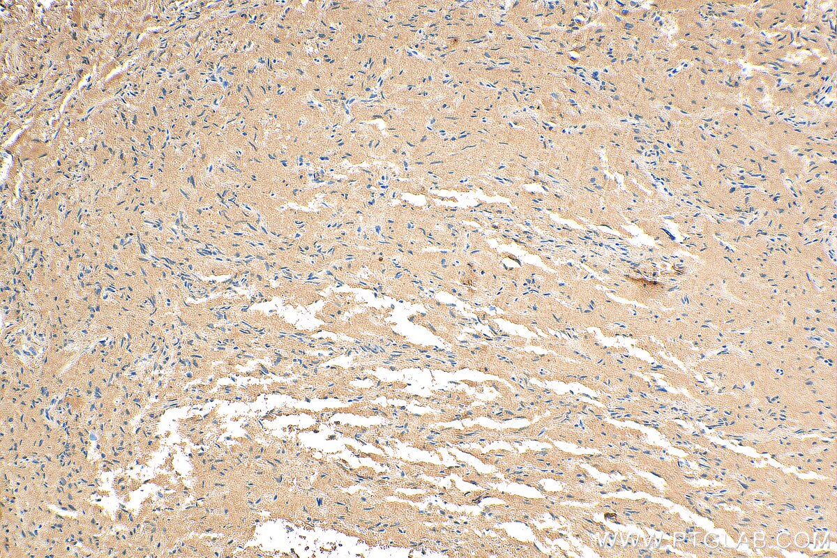 Immunohistochemistry (IHC) staining of human pituitary tissue using Calcyon Polyclonal antibody (13703-1-AP)