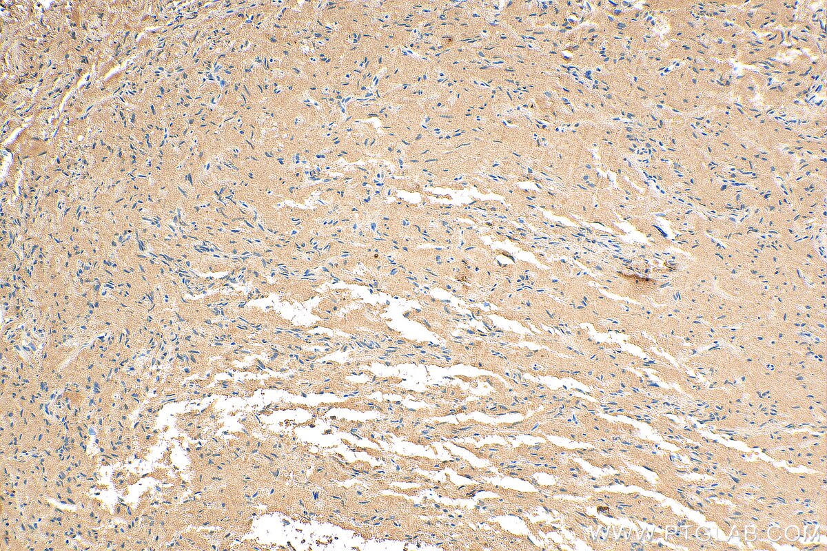 IHC staining of human pituitary using 13703-1-AP