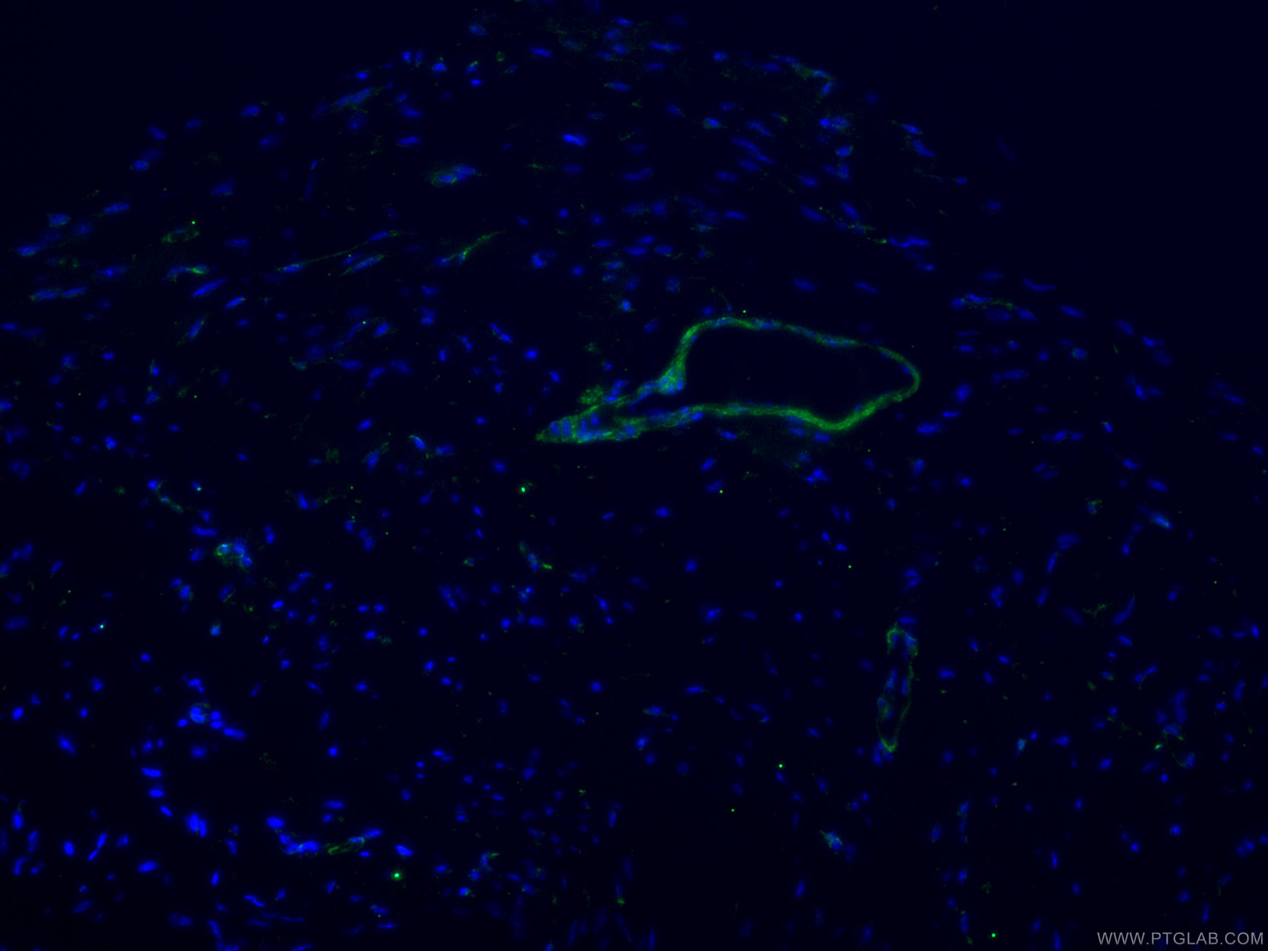 Immunofluorescence (IF) / fluorescent staining of mouse heart tissue using Caldesmon Polyclonal antibody (20887-1-AP)