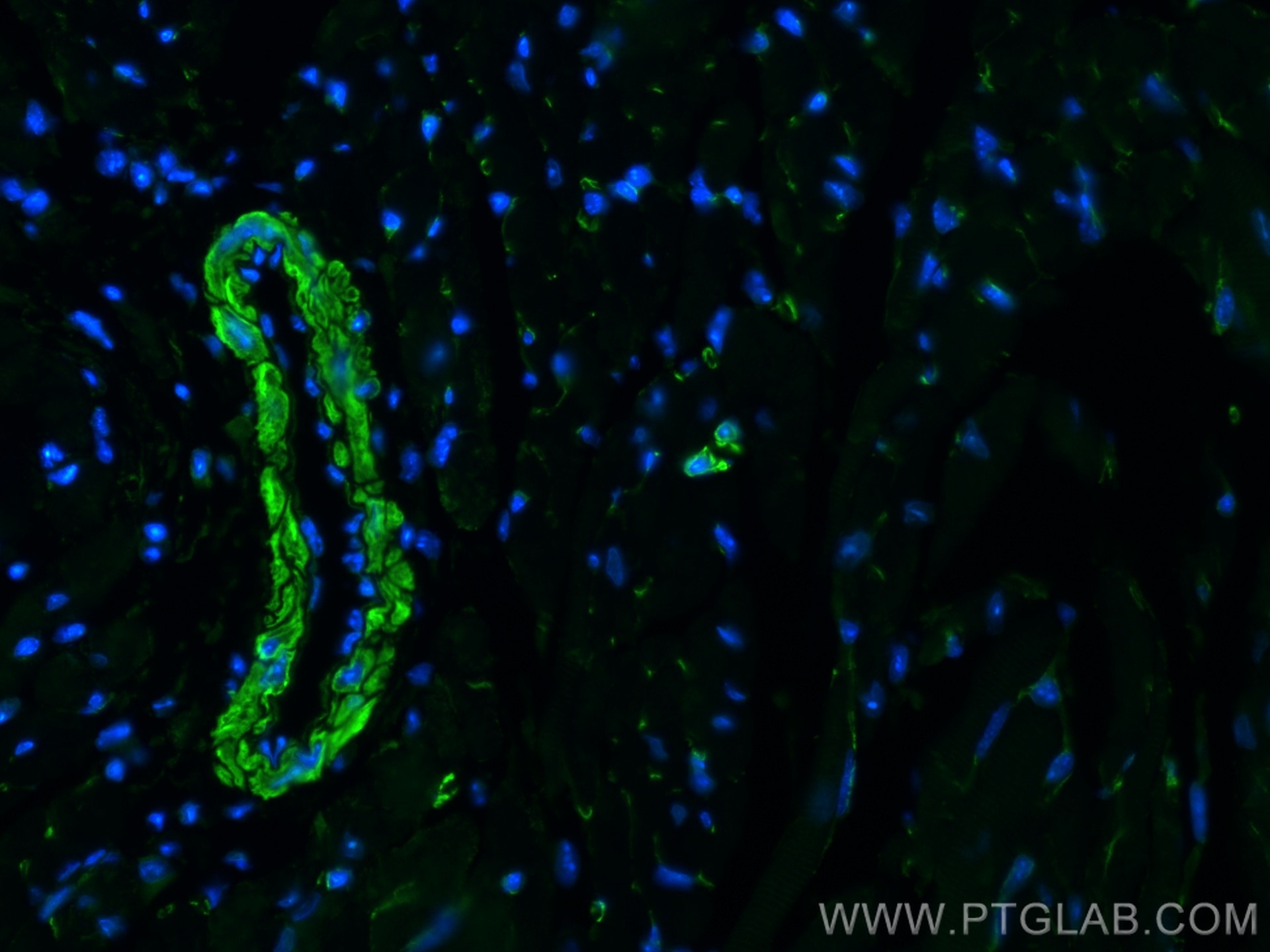 Immunofluorescence (IF) / fluorescent staining of mouse heart tissue using Caldesmon Polyclonal antibody (20887-1-AP)