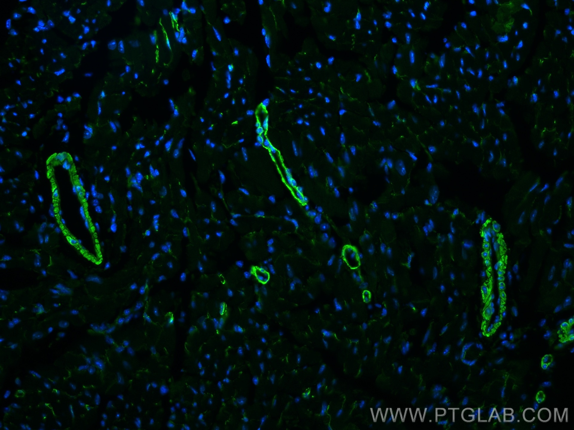 Immunofluorescence (IF) / fluorescent staining of mouse heart tissue using Caldesmon Polyclonal antibody (20887-1-AP)