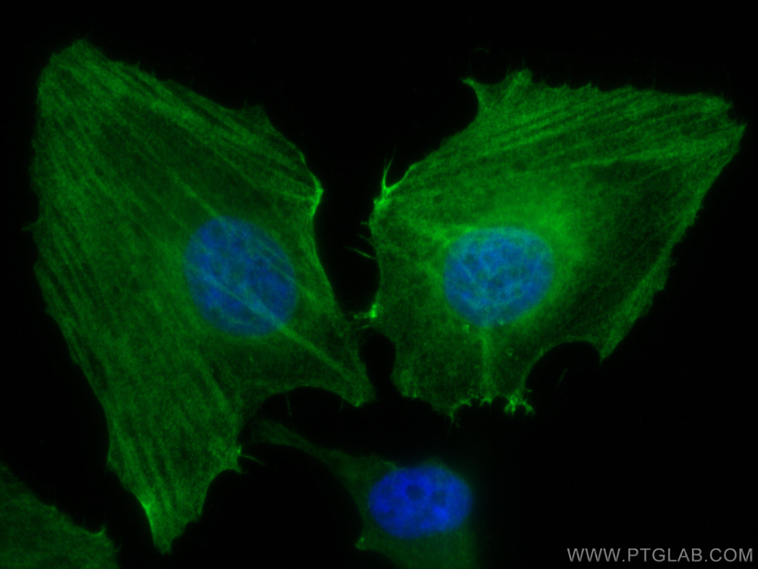 Immunofluorescence (IF) / fluorescent staining of HeLa cells using Caldesmon Polyclonal antibody (20887-1-AP)