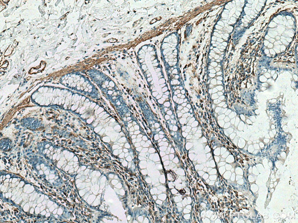 Immunohistochemistry (IHC) staining of human colon tissue using Caldesmon Polyclonal antibody (20887-1-AP)