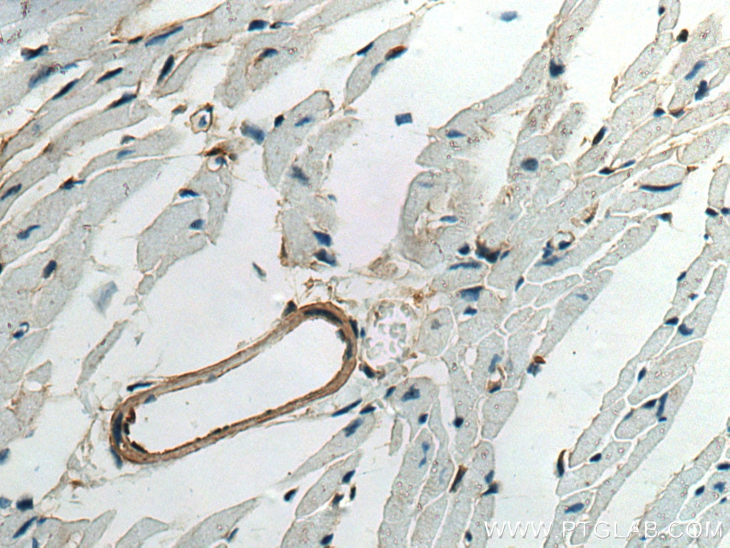 Immunohistochemistry (IHC) staining of mouse heart tissue using Caldesmon Polyclonal antibody (20887-1-AP)