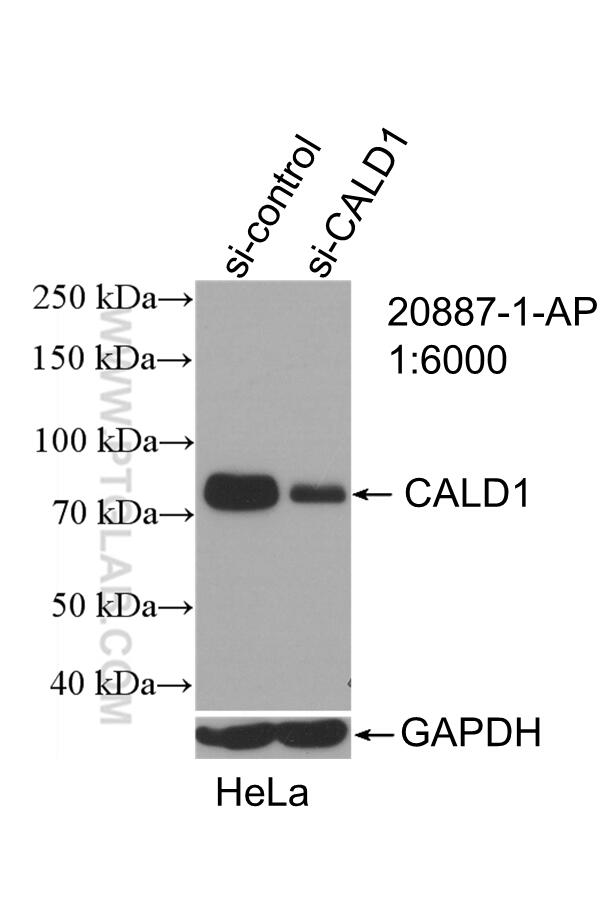 Western Blot (WB) analysis of HeLa cells using Caldesmon Polyclonal antibody (20887-1-AP)
