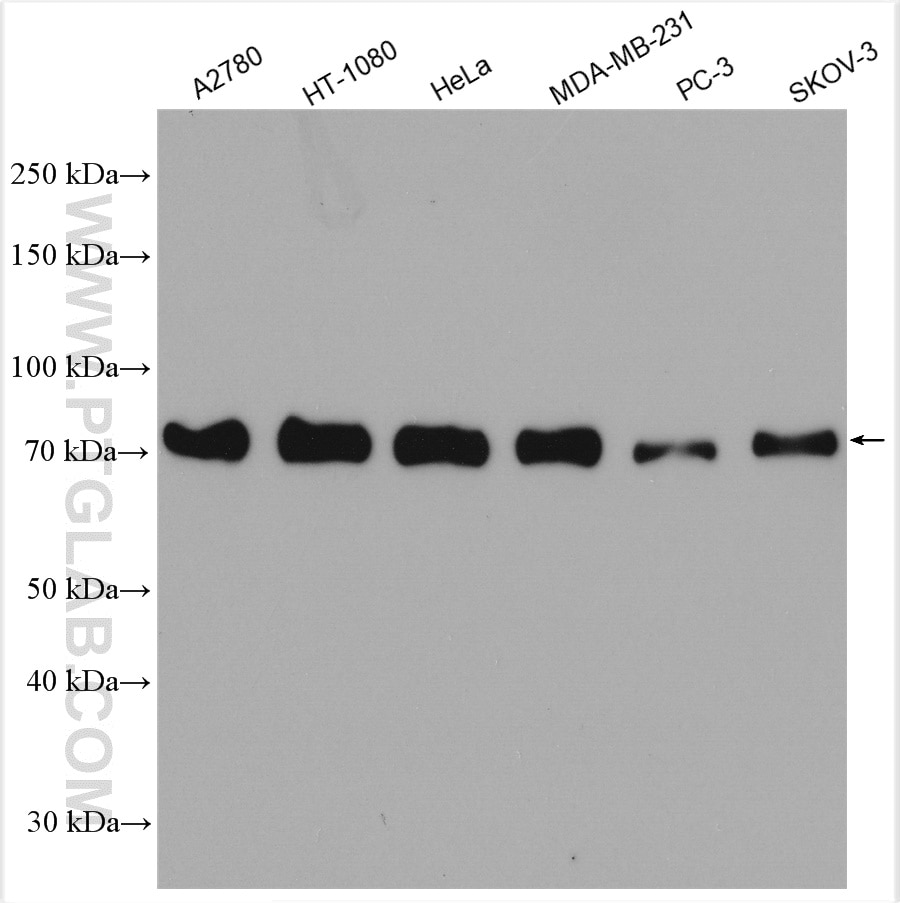 Western Blot (WB) analysis of various lysates using Caldesmon Polyclonal antibody (20887-1-AP)