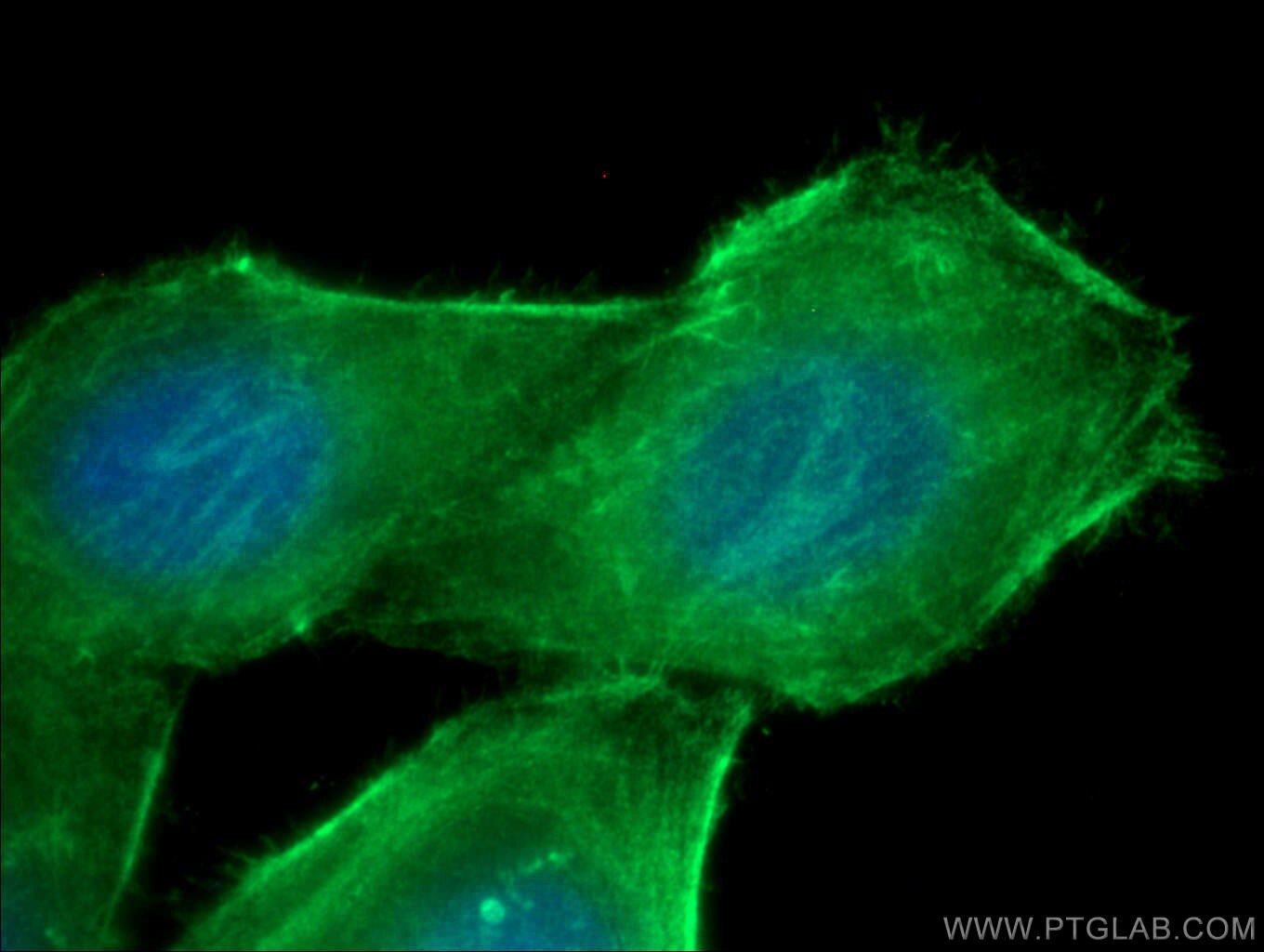 Immunofluorescence (IF) / fluorescent staining of HepG2 cells using CALD1 Monoclonal antibody (66693-1-Ig)