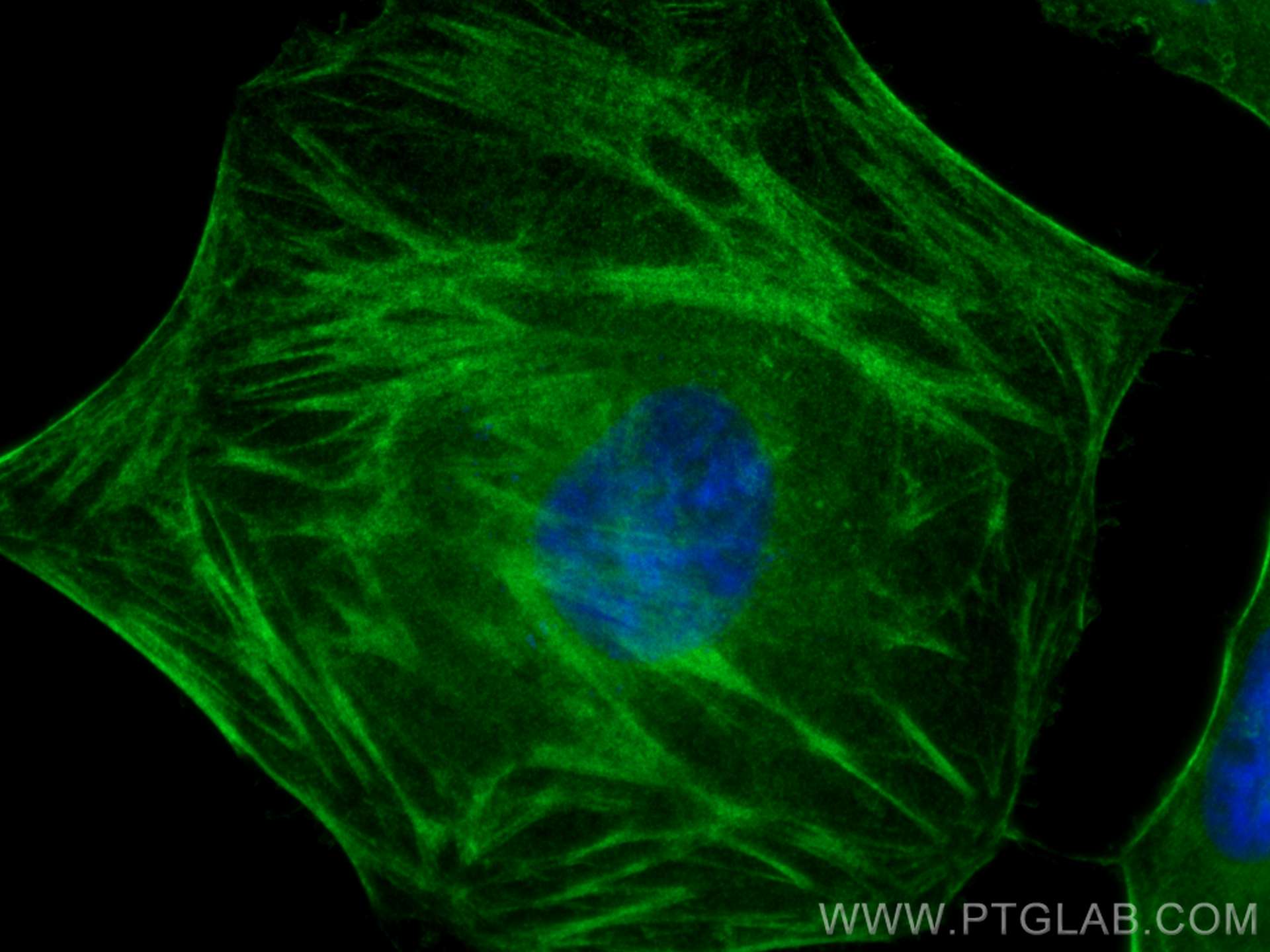 Immunofluorescence (IF) / fluorescent staining of HeLa cells using CALD1 Monoclonal antibody (66693-1-Ig)