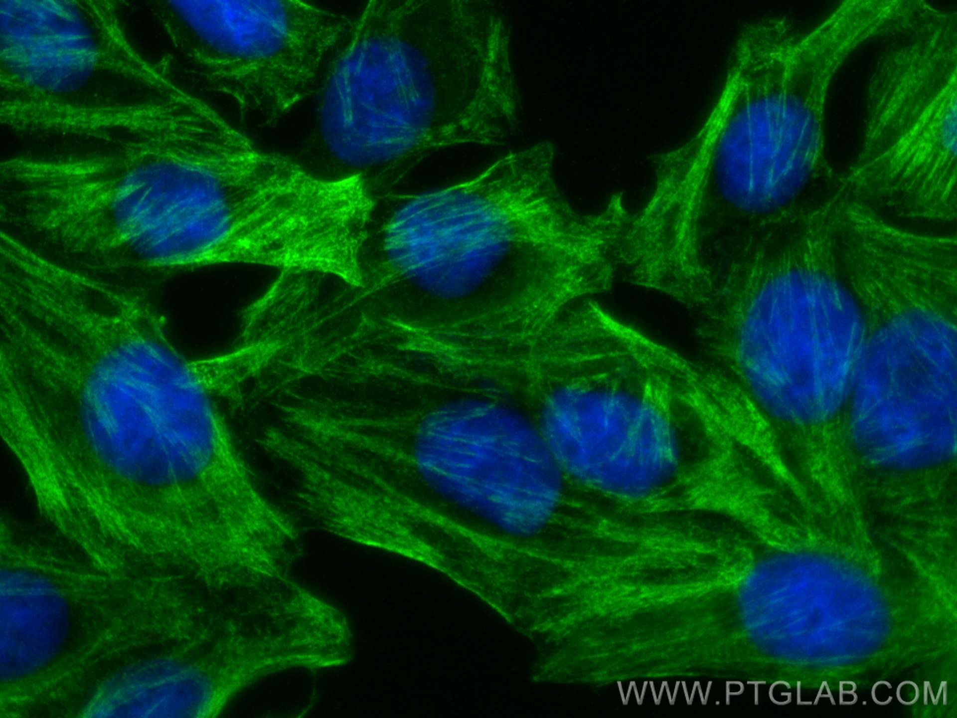 Immunofluorescence (IF) / fluorescent staining of HepG2 cells using CALD1 Monoclonal antibody (66693-1-Ig)