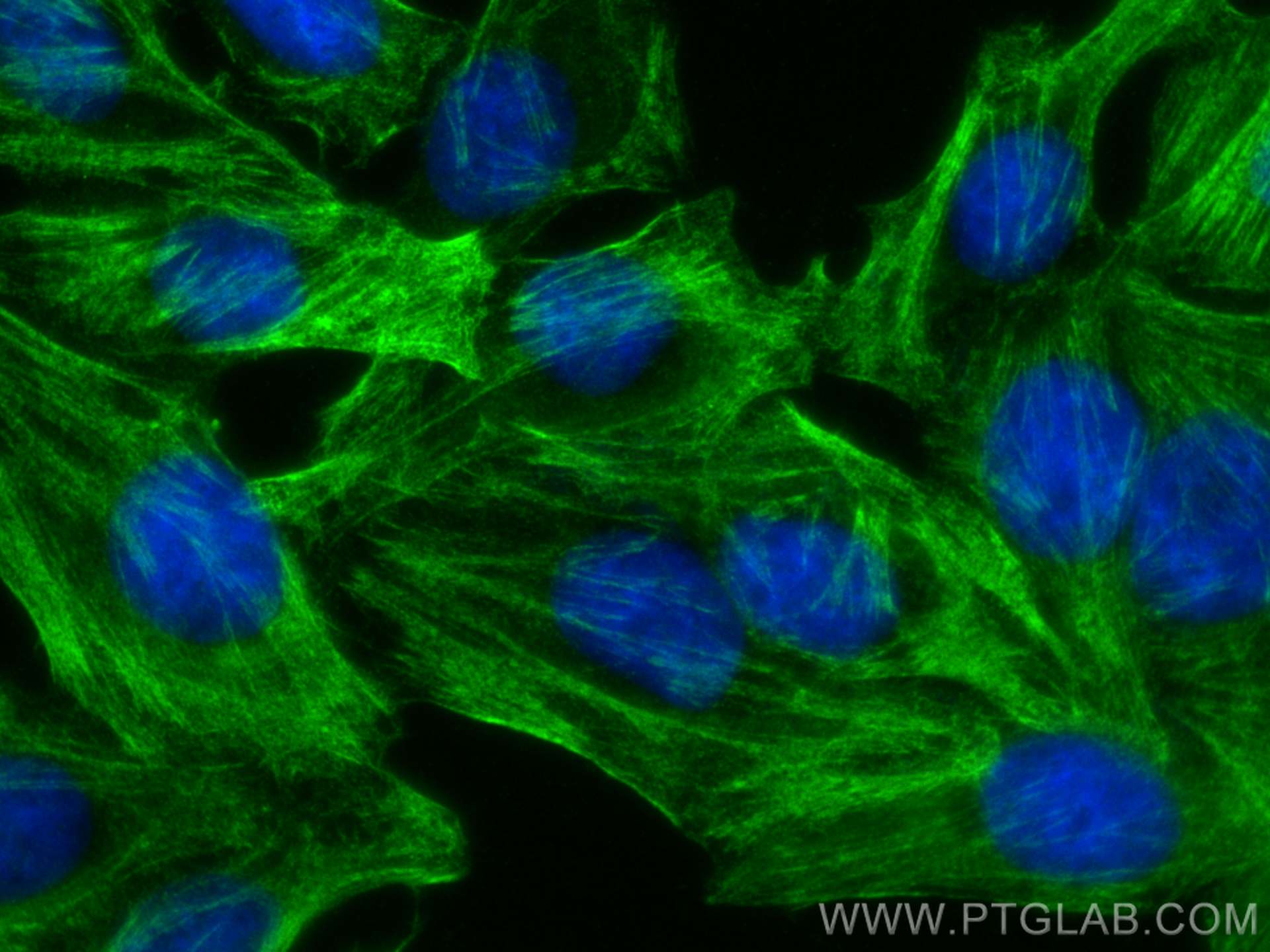 IF Staining of HepG2 using 66693-1-Ig