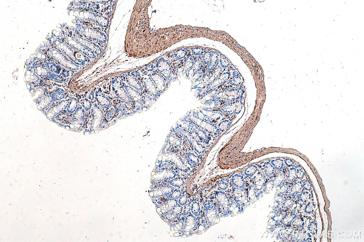 Immunohistochemistry (IHC) staining of mouse colon tissue using CALD1 Monoclonal antibody (66693-1-Ig)