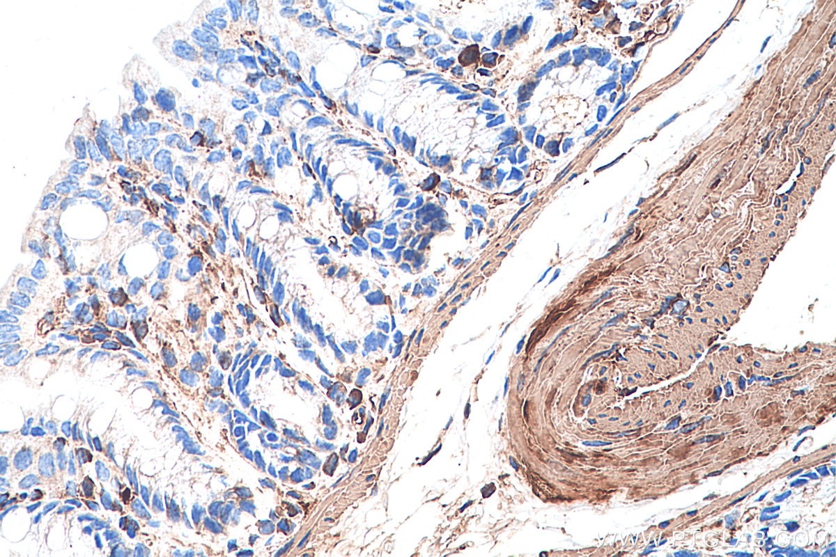 Immunohistochemistry (IHC) staining of mouse colon tissue using CALD1 Monoclonal antibody (66693-1-Ig)