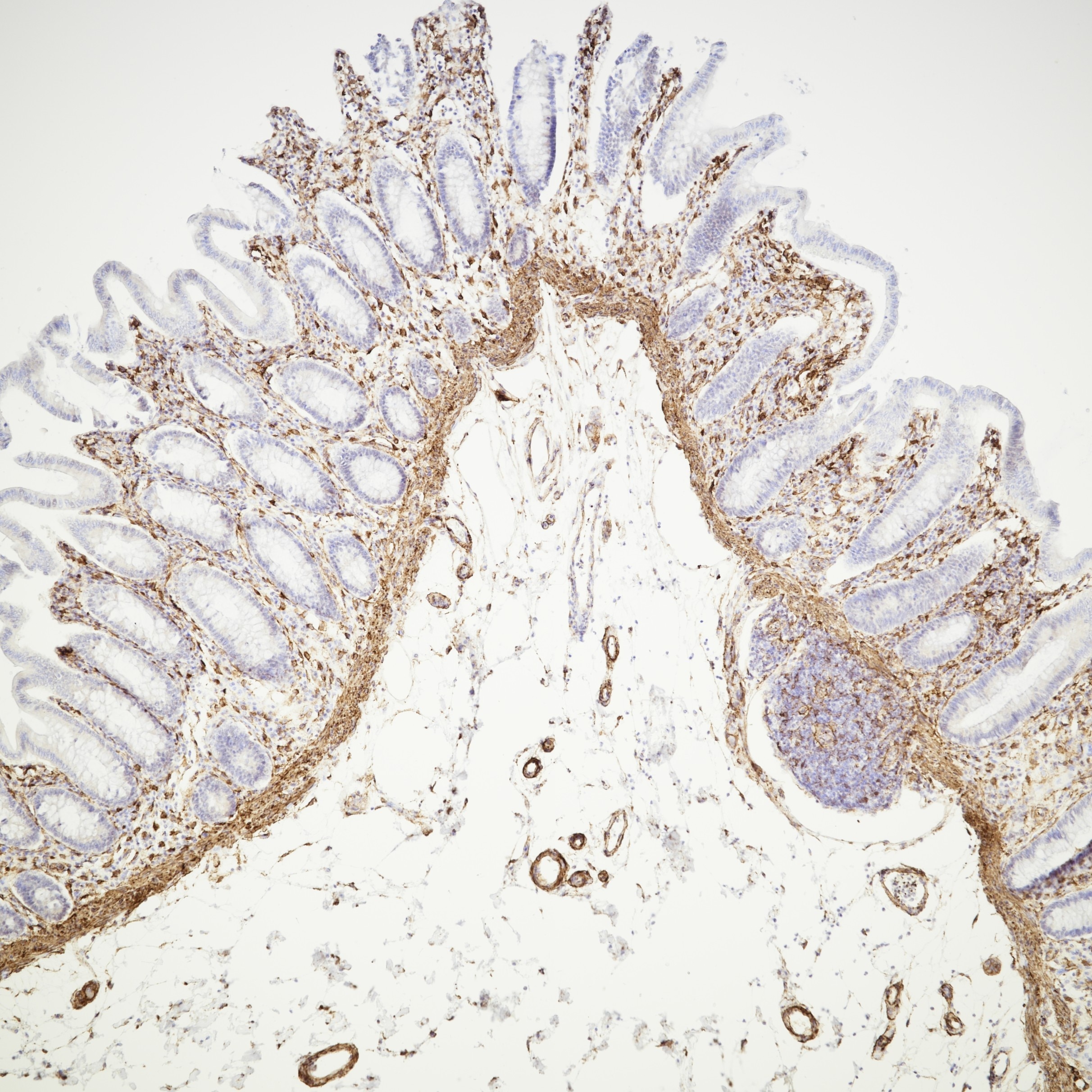 Immunohistochemistry (IHC) staining of human colon tissue using Caldesmon Monoclonal antibody (66693-1-Ig)