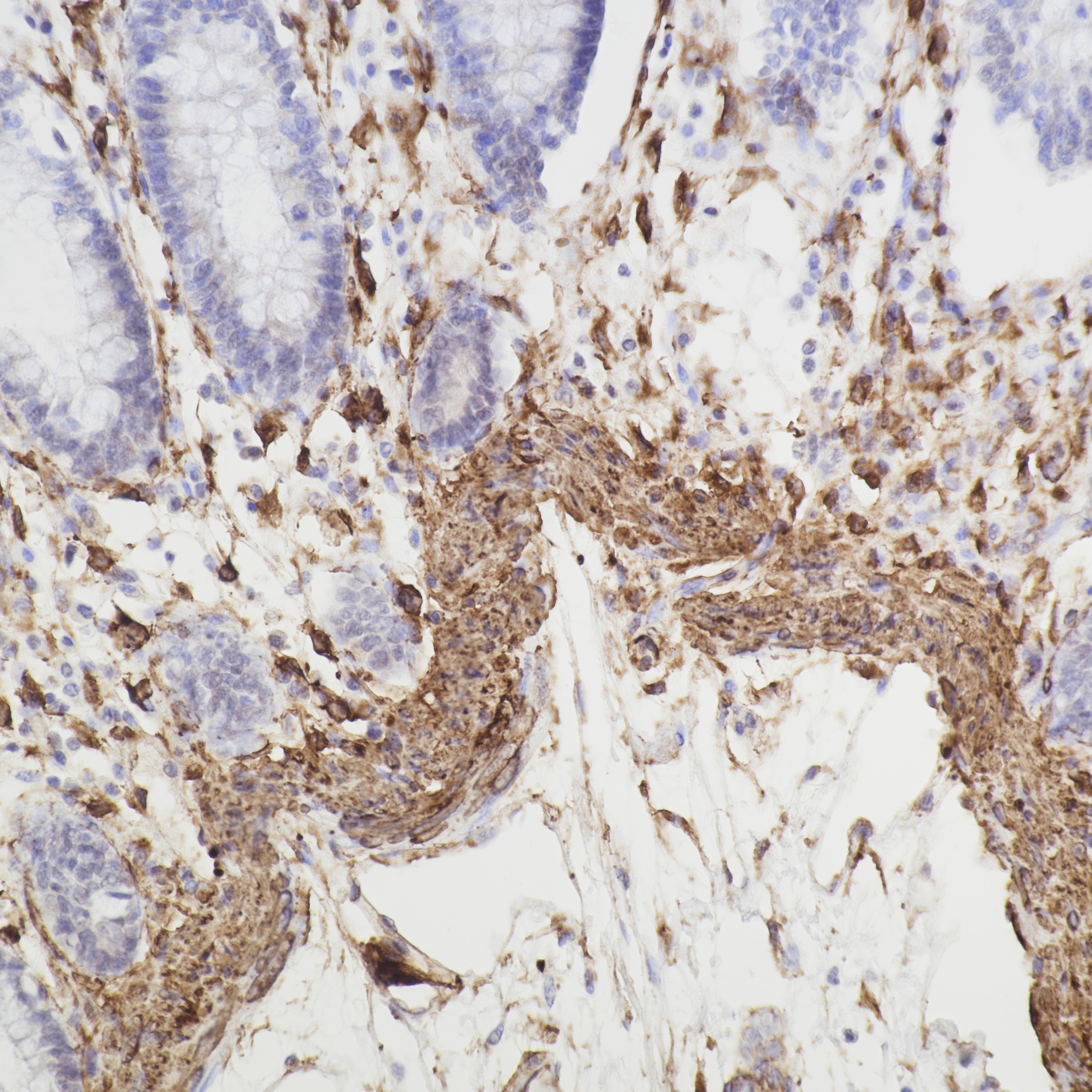 Immunohistochemistry (IHC) staining of human colon tissue using Caldesmon Monoclonal antibody (66693-1-Ig)